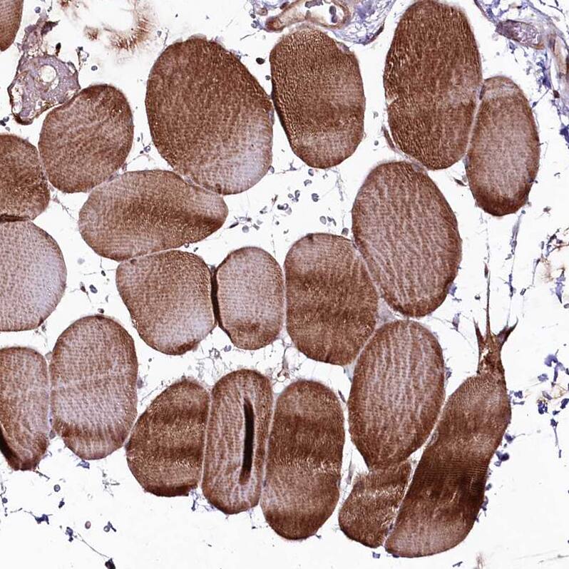 PHLDB1 Antibody - BSA Free Immunohistochemistry: PHLDB1 Antibody - BSA Free [NBP1-90451]