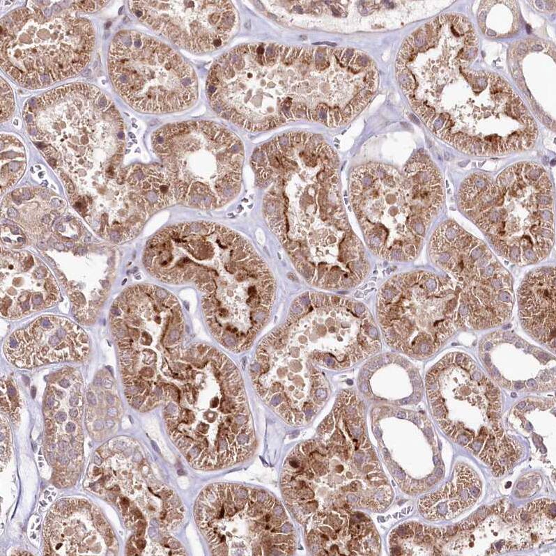 PHLDB1 Antibody - BSA Free Immunohistochemistry: PHLDB1 Antibody - BSA Free [NBP1-90451]