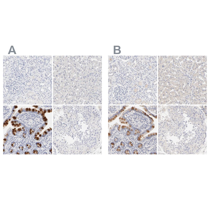 FCGBP Antibody Immunohistochemistry-Paraffin: FCGBP Antibody Antibody [NBP1-90461]
