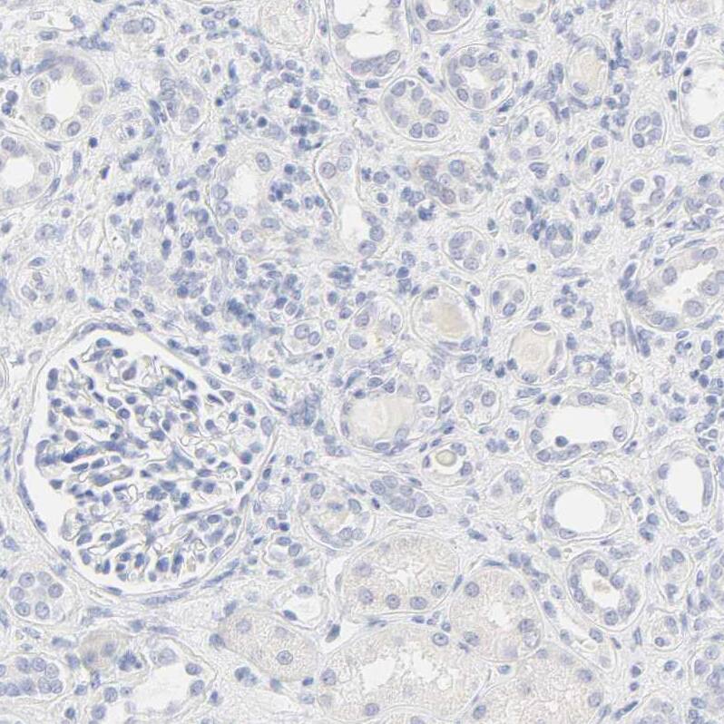 FCGBP Antibody - BSA Free Immunohistochemistry: FCGBP Antibody - BSA Free [NBP1-90461]