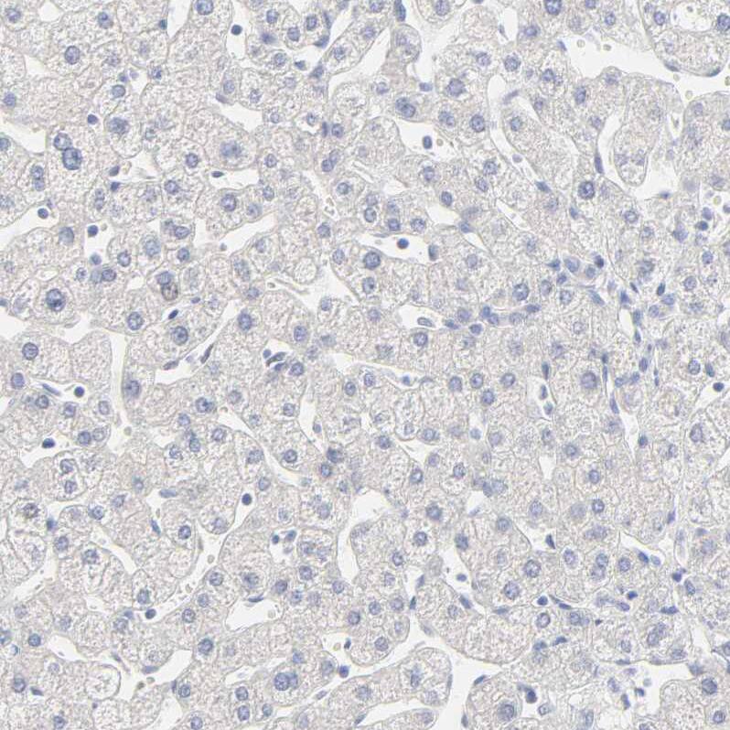 FCGBP Antibody - BSA Free Immunohistochemistry: FCGBP Antibody - BSA Free [NBP1-90461]