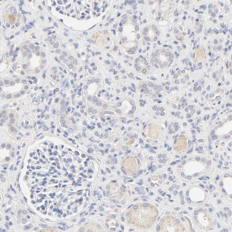 FCGBP Antibody - BSA Free Immunohistochemistry: FCGBP Antibody - BSA Free [NBP1-90462]