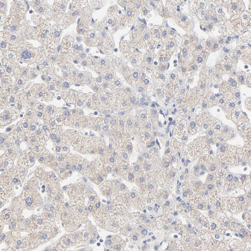 FCGBP Antibody - BSA Free Immunohistochemistry: FCGBP Antibody - BSA Free [NBP1-90462]