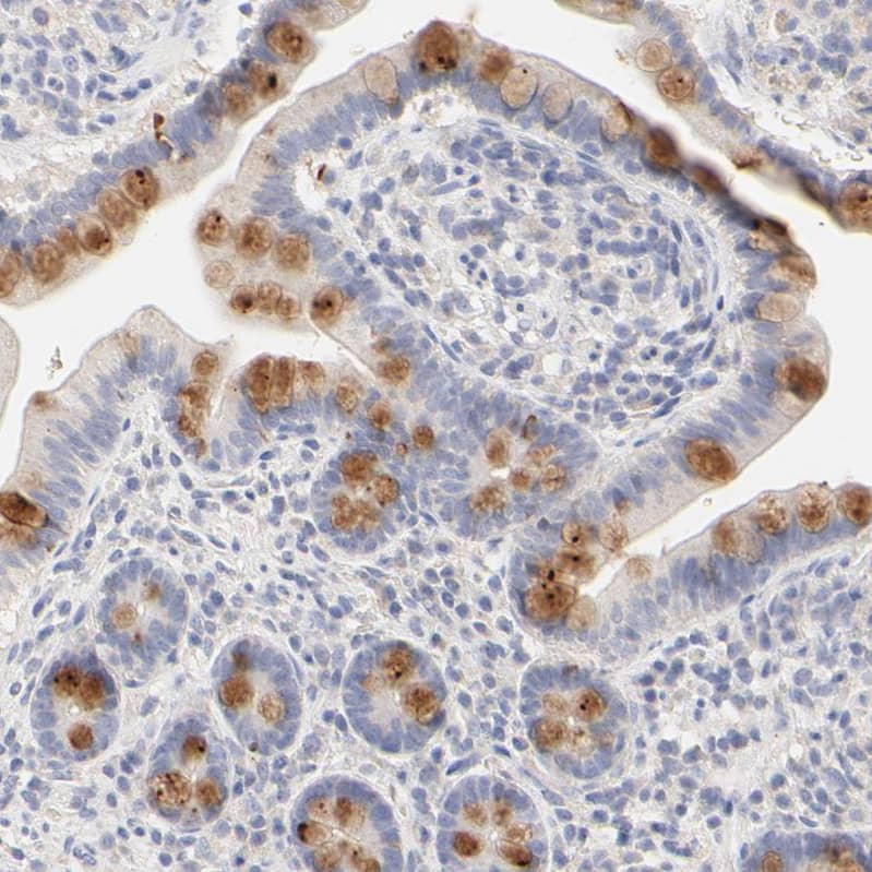 FCGBP Antibody - BSA Free Immunohistochemistry: FCGBP Antibody - BSA Free [NBP1-90462]