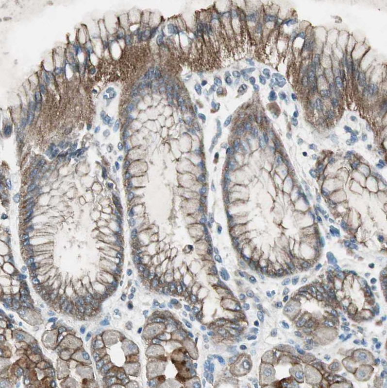 NKAIN1 Antibody - BSA Free Immunohistochemistry: NKAIN1 Antibody - BSA Free [NBP1-90463]