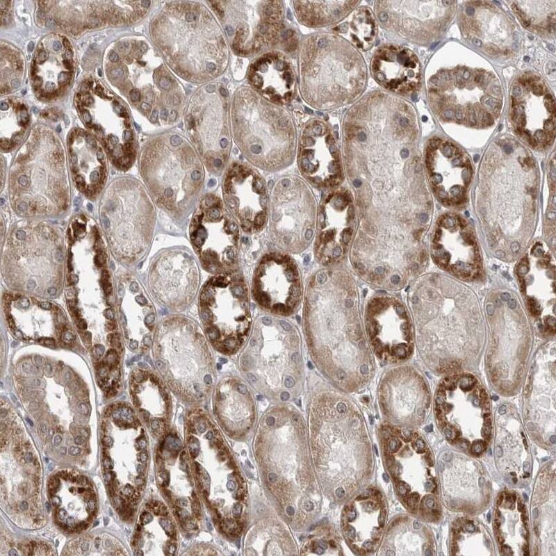 FAAP100 Antibody - BSA Free Immunohistochemistry-Paraffin: FAAP100 Antibody [NBP1-90468]