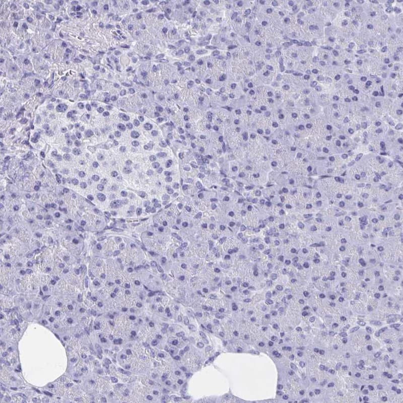 C10orf53 Antibody - BSA Free Immunohistochemistry: C10orf53 Antibody - BSA Free [NBP1-90476]