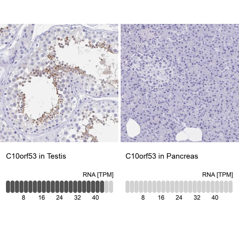C10orf53 Antibody - BSA Free Immunohistochemistry: C10orf53 Antibody - BSA Free [NBP1-90476]