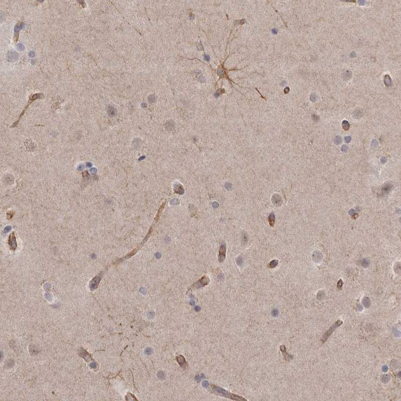 Ells1 Antibody - BSA Free Immunohistochemistry: Ells1 Antibody - BSA Free [NBP1-90477]