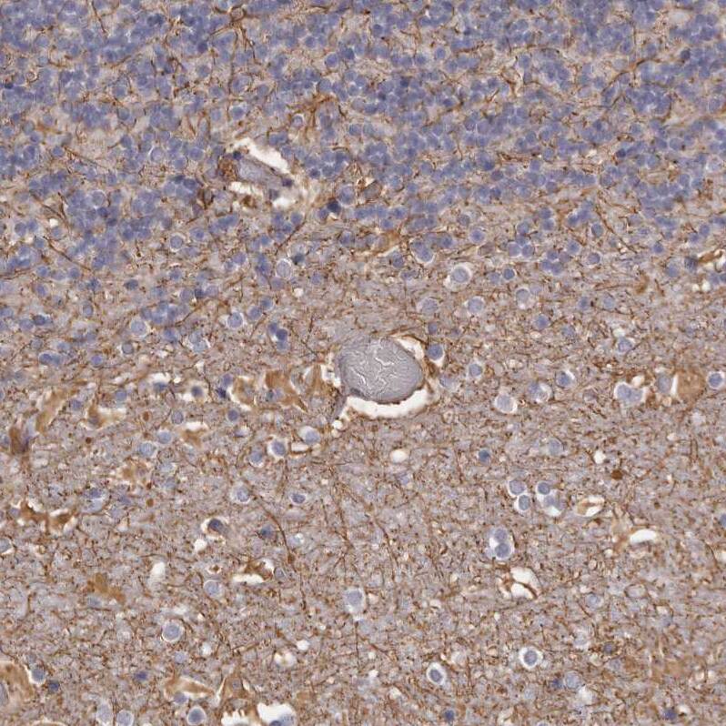 Ells1 Antibody - BSA Free Immunohistochemistry: Ells1 Antibody - BSA Free [NBP1-90477]