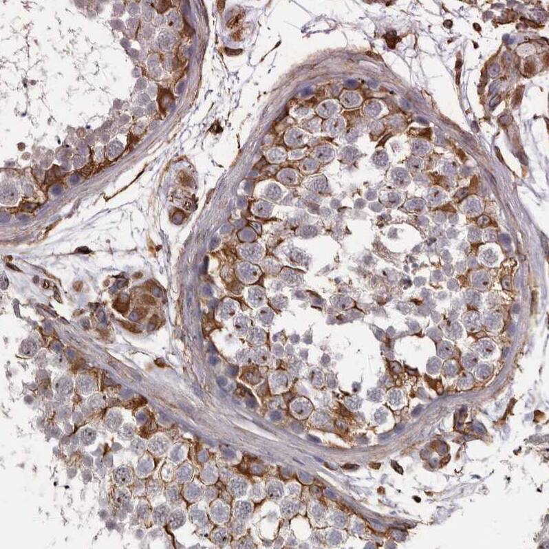 Ells1 Antibody - BSA Free Immunohistochemistry: Ells1 Antibody - BSA Free [NBP1-90477]
