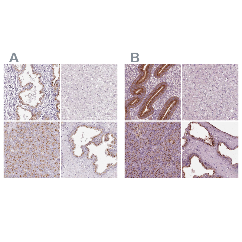 EIG121 Antibody - BSA Free Immunohistochemistry: EIG121 Antibody - BSA Free [NBP1-90479]