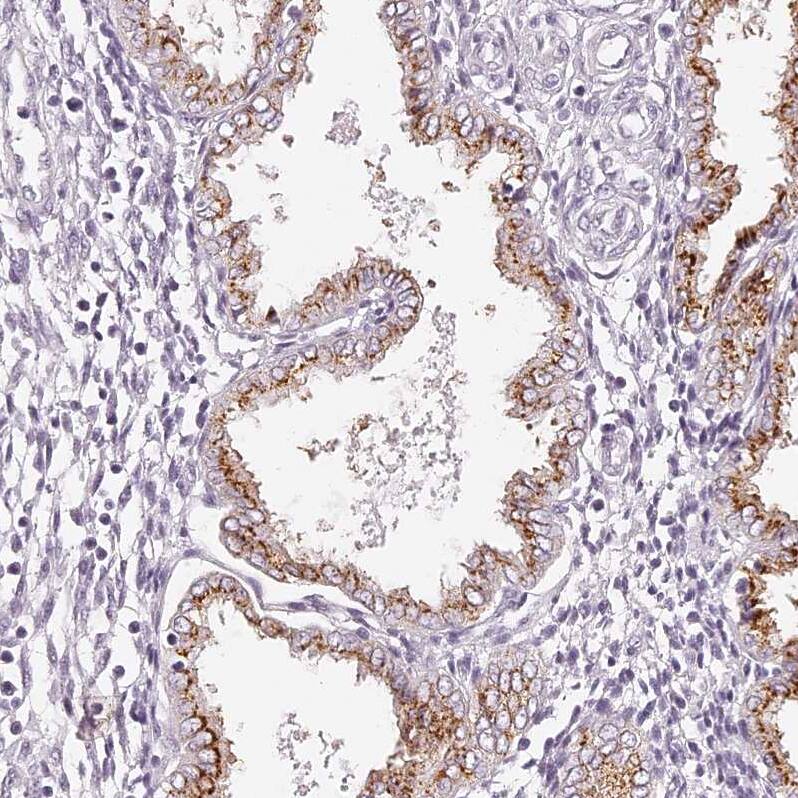EIG121 Antibody - BSA Free Immunohistochemistry: EIG121 Antibody - BSA Free [NBP1-90479]