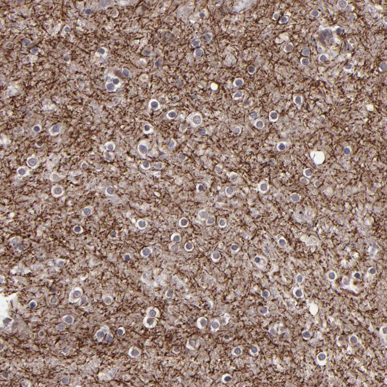 SIPA1L1 Antibody - BSA Free Immunohistochemistry: SIPA1L1 Antibody - BSA Free [NBP1-90482]