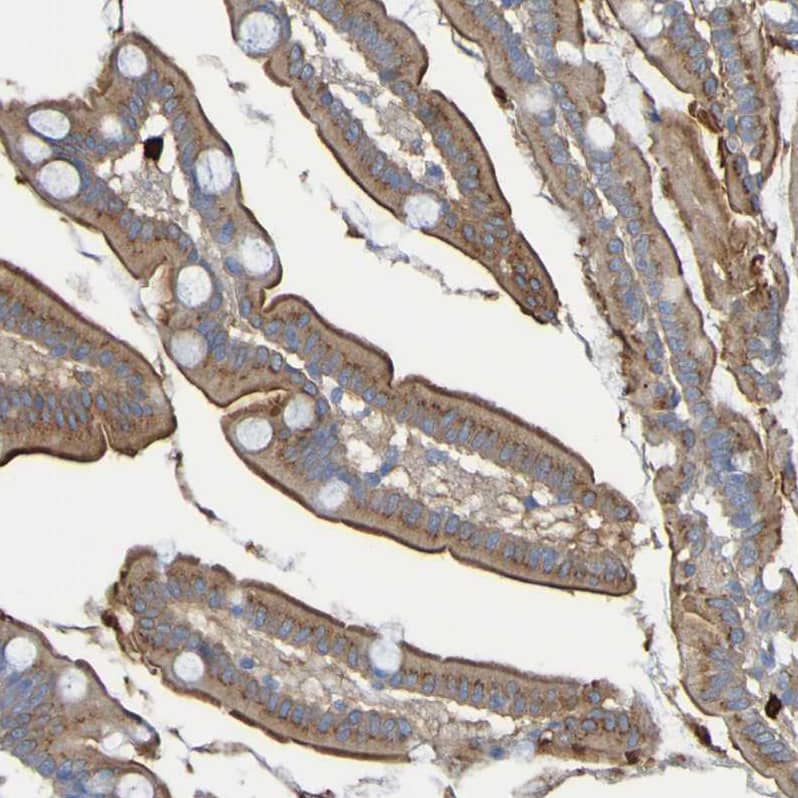 C11orf24 Antibody - BSA Free Immunohistochemistry: C11orf24 Antibody - BSA Free [NBP1-90493]