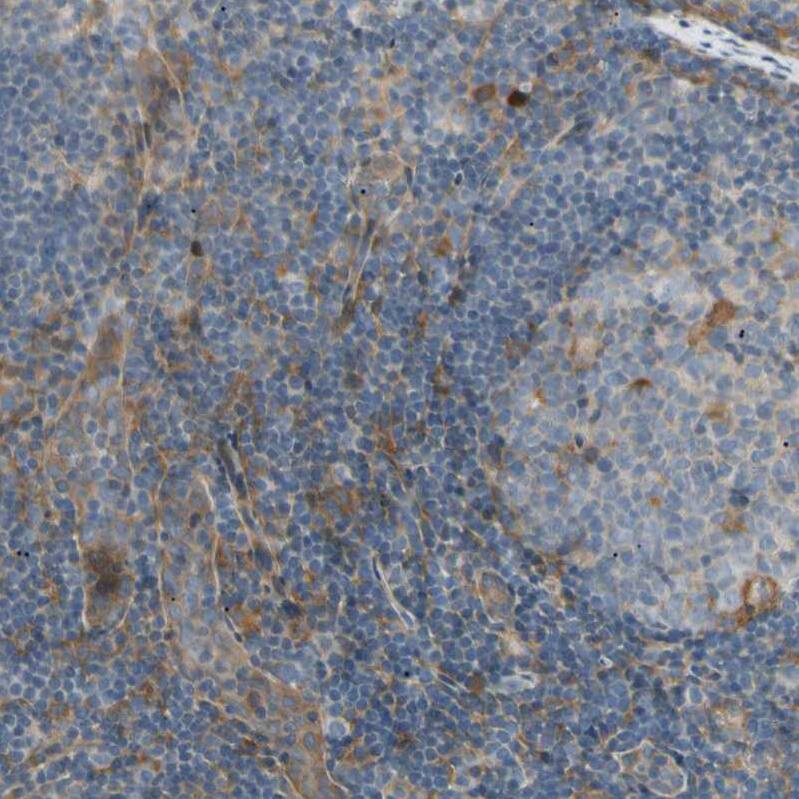 FNDC3B Antibody - BSA Free Immunohistochemistry: FNDC3B Antibody - BSA Free [NBP1-90495]