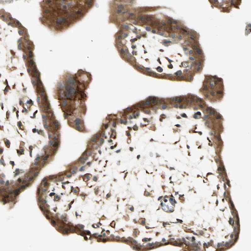 FNDC3B Antibody - BSA Free Immunohistochemistry: FNDC3B Antibody - BSA Free [NBP1-90495]