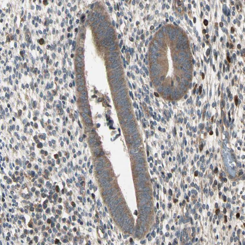 FNDC3B Antibody - BSA Free Immunohistochemistry: FNDC3B Antibody - BSA Free [NBP1-90495]