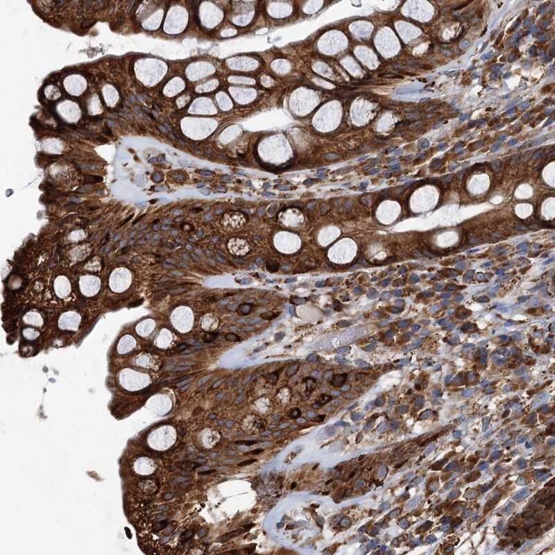 NEURL1B Antibody - BSA Free Immunohistochemistry-Paraffin: NEURL1B Antibody [NBP1-90499]