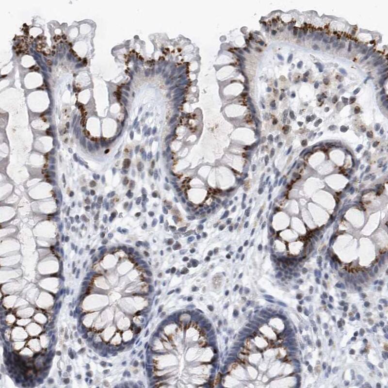 VWA5B2 Antibody - BSA Free Immunohistochemistry: VWA5B2 Antibody - BSA Free [NBP1-90500]