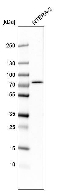 TBC1D15 Antibody - BSA Free Western Blot: TBC1D15 Antibody - BSA Free [NBP1-90503]