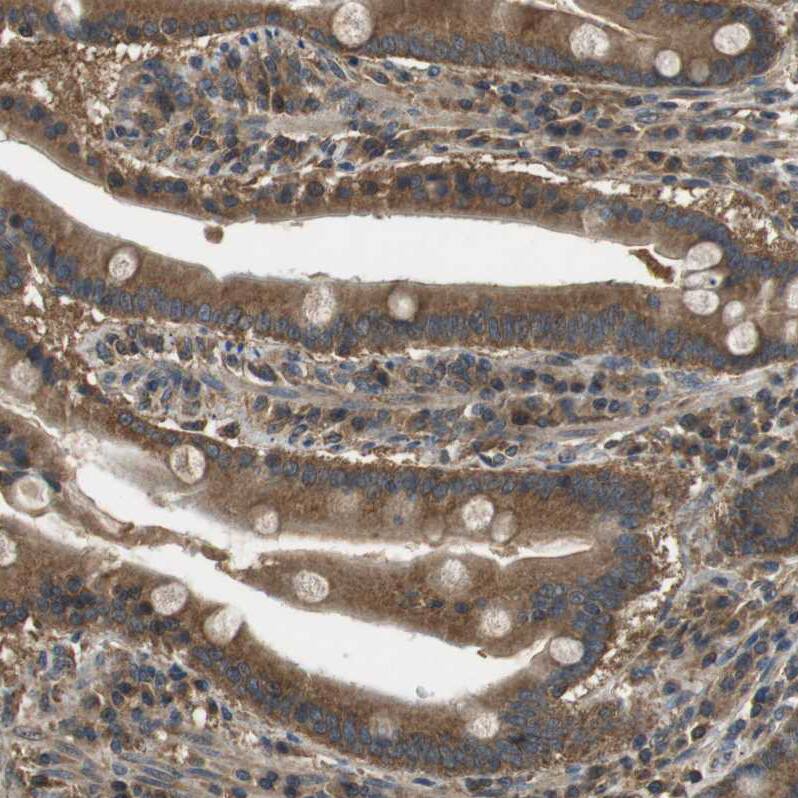 TBC1D15 Antibody - BSA Free Immunohistochemistry: TBC1D15 Antibody - BSA Free [NBP1-90504]