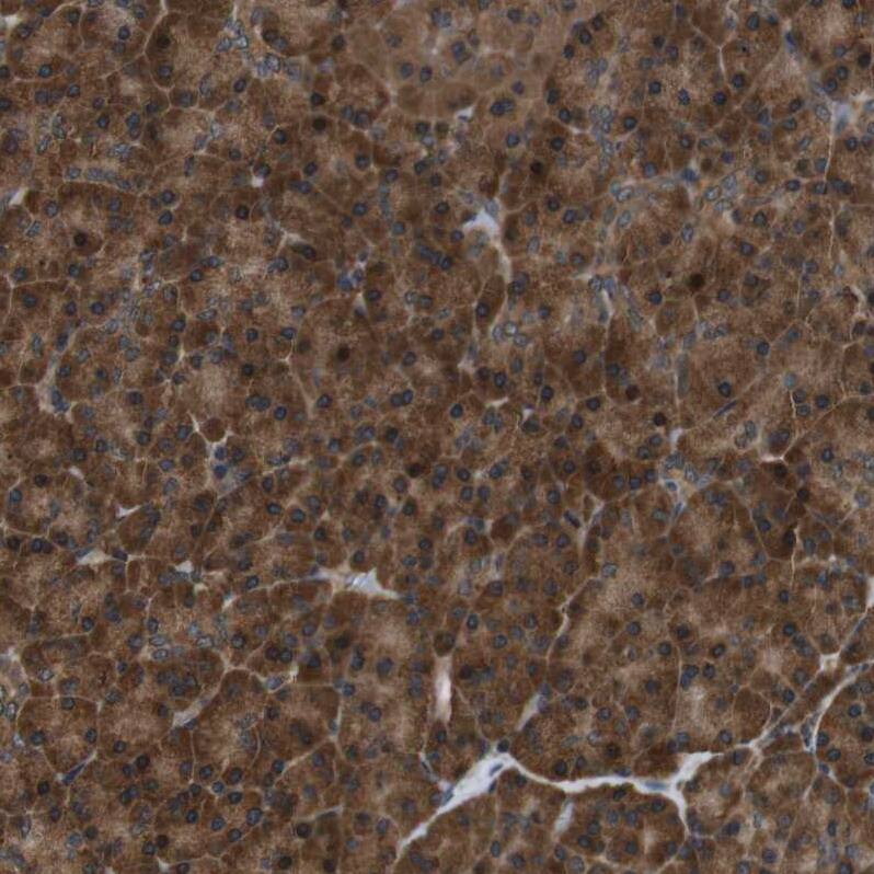 TBC1D15 Antibody - BSA Free Immunohistochemistry: TBC1D15 Antibody - BSA Free [NBP1-90504]