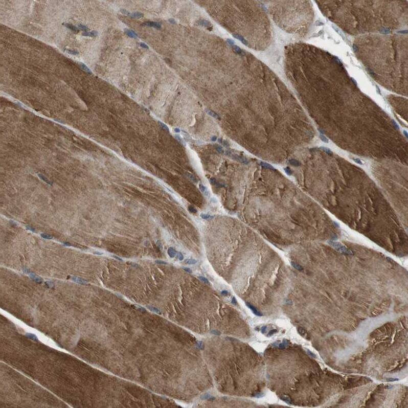 TBC1D15 Antibody - BSA Free Immunohistochemistry: TBC1D15 Antibody - BSA Free [NBP1-90504]