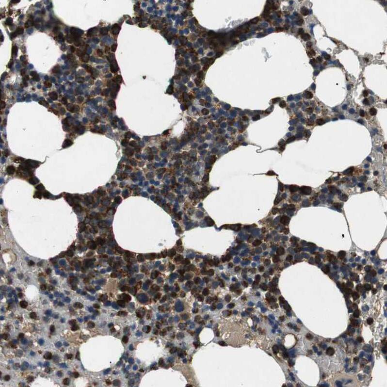 TBC1D15 Antibody - BSA Free Immunohistochemistry: TBC1D15 Antibody - BSA Free [NBP1-90504]