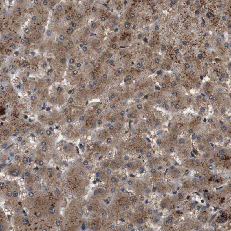 TBC1D15 Antibody - BSA Free Immunohistochemistry: TBC1D15 Antibody - BSA Free [NBP1-90504]