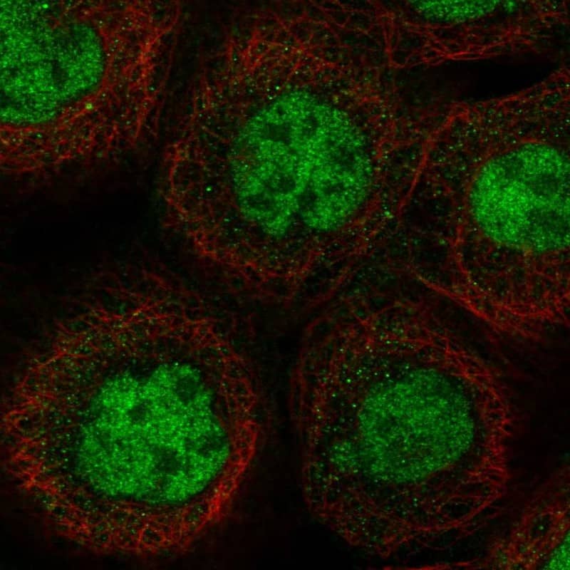MSL1 Antibody - BSA Free Immunocytochemistry/ Immunofluorescence: MSL1 Antibody [NBP1-90505]