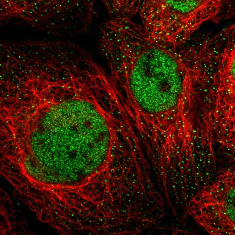 MSL1 Antibody - BSA Free Immunocytochemistry/ Immunofluorescence: MSL1 Antibody [NBP1-90506]
