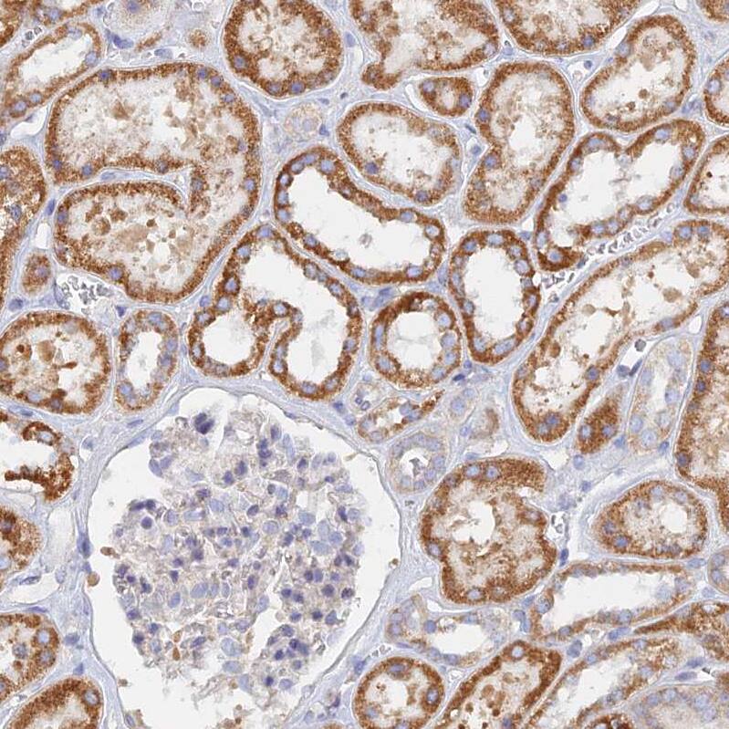 TMEM44 Antibody - BSA Free Immunohistochemistry: TMEM44 Antibody - BSA Free [NBP1-90507]