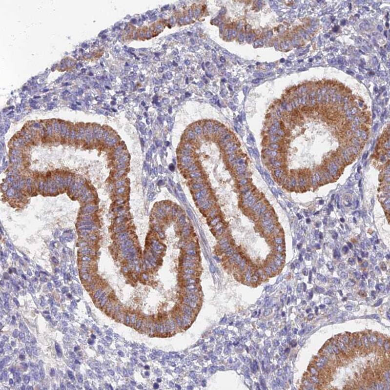 TMEM44 Antibody - BSA Free Immunohistochemistry: TMEM44 Antibody - BSA Free [NBP1-90507]