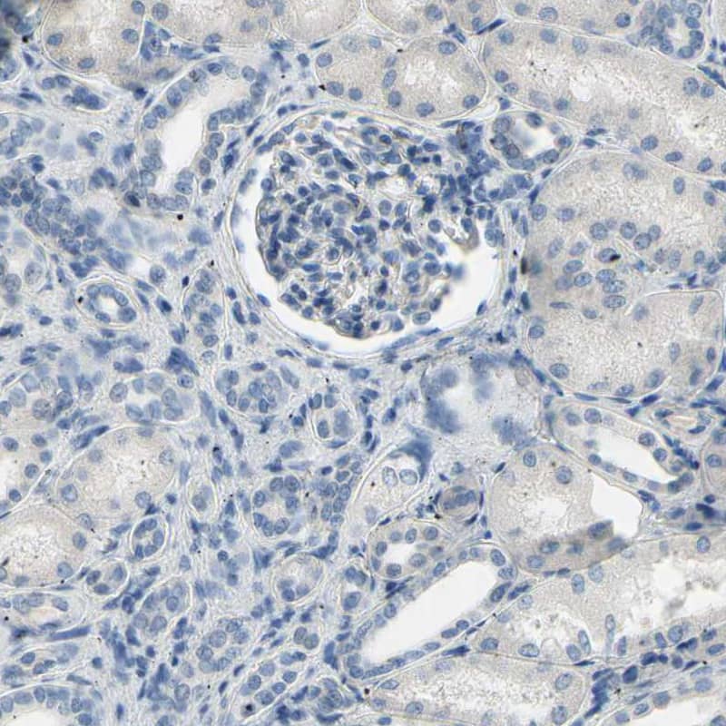 SPINK5 Antibody - BSA Free Immunohistochemistry: SPINK5 Antibody - BSA Free [NBP1-90510]
