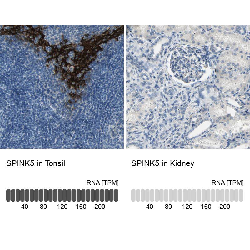 SPINK5 Antibody - BSA Free Immunohistochemistry: SPINK5 Antibody - BSA Free [NBP1-90510]