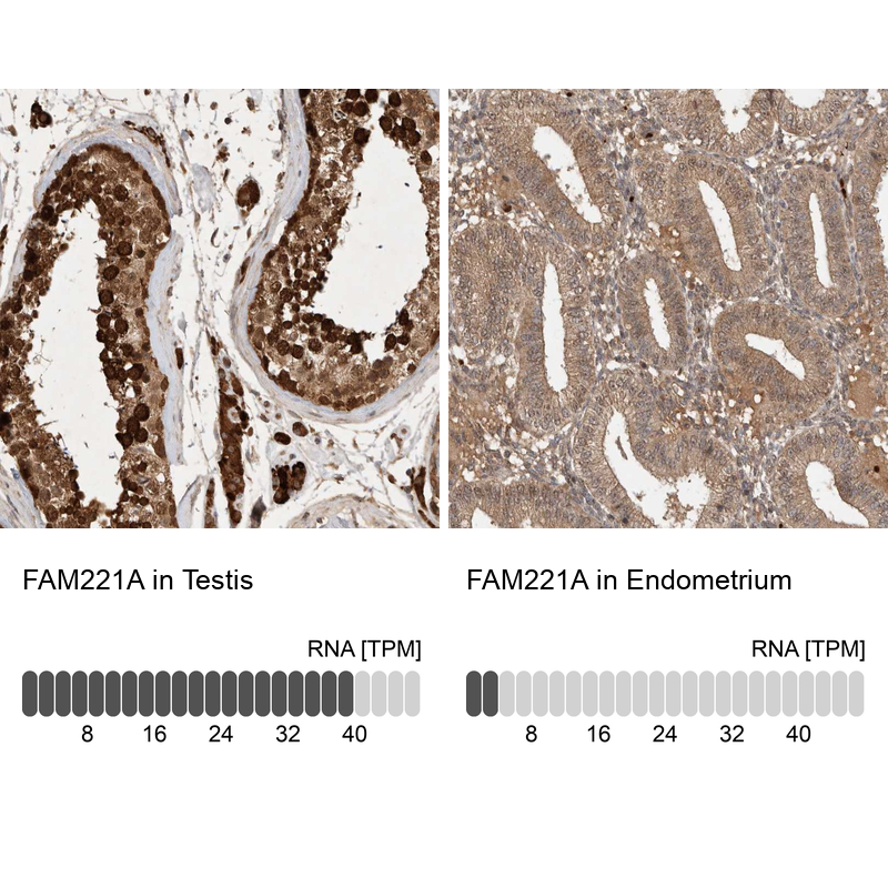 FAM221A Antibody - BSA Free Immunohistochemistry: FAM221A Antibody - BSA Free [NBP1-90513]