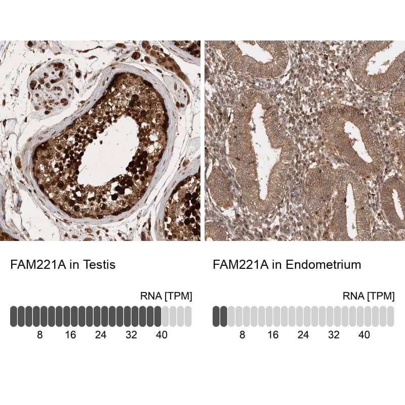 FAM221A Antibody - BSA Free Immunohistochemistry: FAM221A Antibody - BSA Free [NBP1-90514]