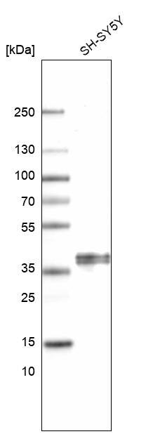 C1orf198 Antibody - BSA Free Western Blot: C1orf198 Antibody - BSA Free [NBP1-90519]