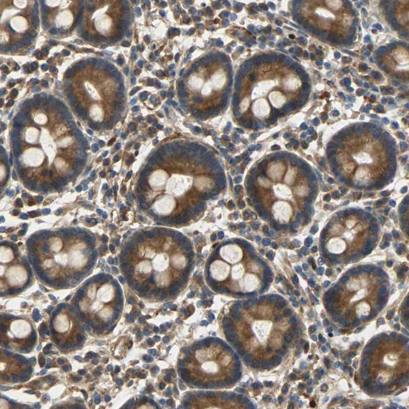 C1orf198 Antibody - BSA Free Immunohistochemistry: C1orf198 Antibody - BSA Free [NBP1-90519]
