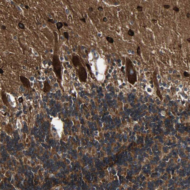 C1orf198 Antibody - BSA Free Immunohistochemistry: C1orf198 Antibody - BSA Free [NBP1-90519]