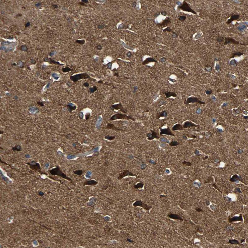 C1orf198 Antibody - BSA Free Immunohistochemistry: C1orf198 Antibody - BSA Free [NBP1-90519]