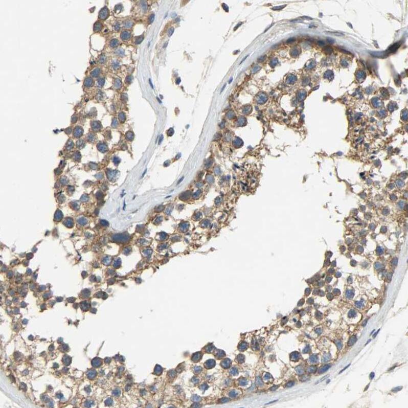 C1orf198 Antibody - BSA Free Immunohistochemistry: C1orf198 Antibody - BSA Free [NBP1-90519]
