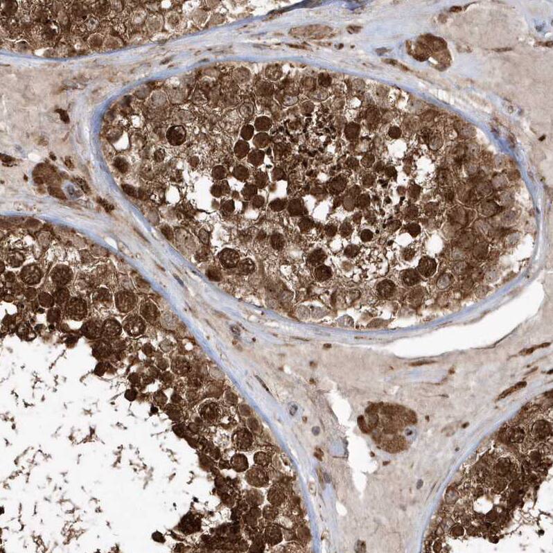 EPC2 Antibody - BSA Free Immunohistochemistry: EPC2 Antibody - BSA Free [NBP1-90523]