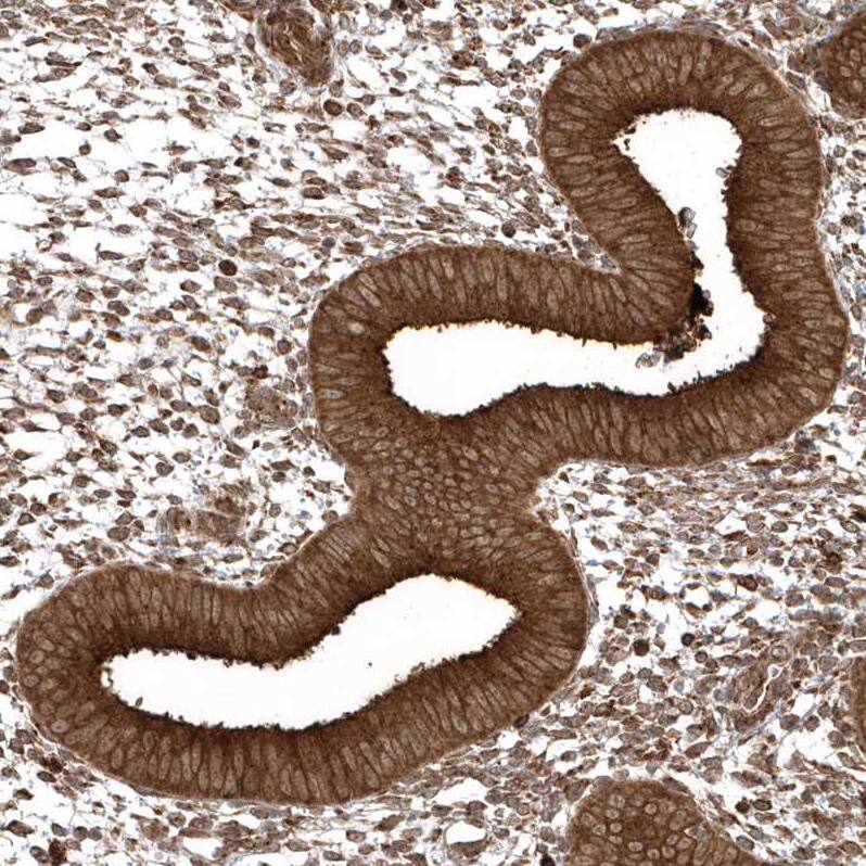 EPC2 Antibody - BSA Free Immunohistochemistry: EPC2 Antibody - BSA Free [NBP1-90523]