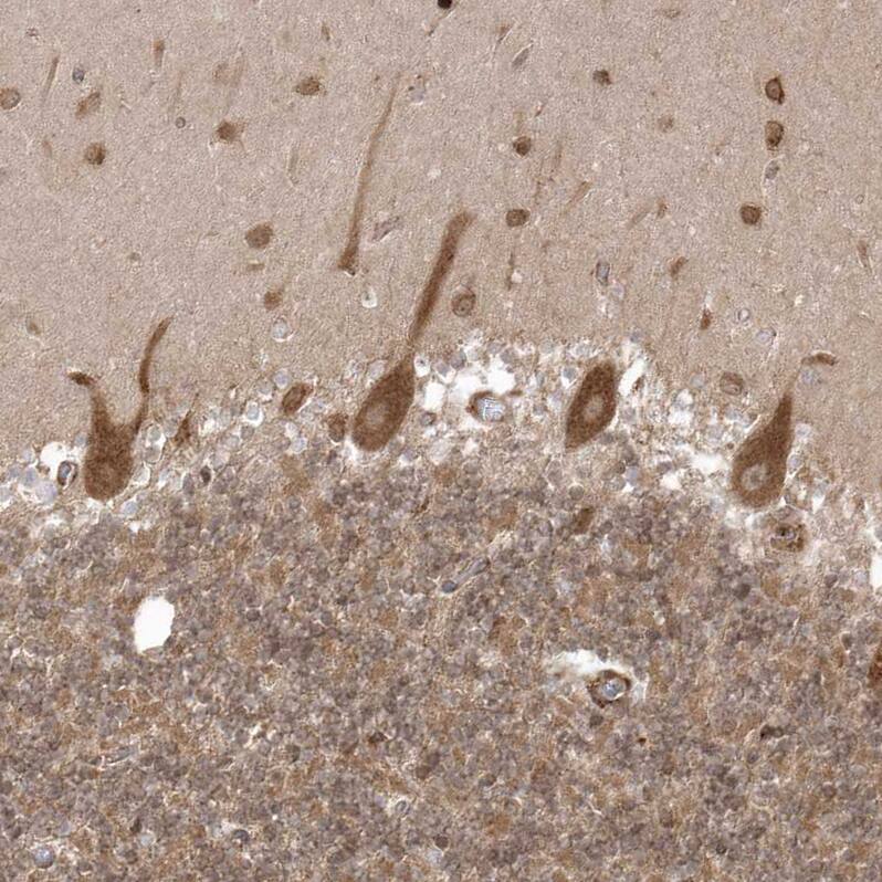 EPC2 Antibody - BSA Free Immunohistochemistry: EPC2 Antibody - BSA Free [NBP1-90523]