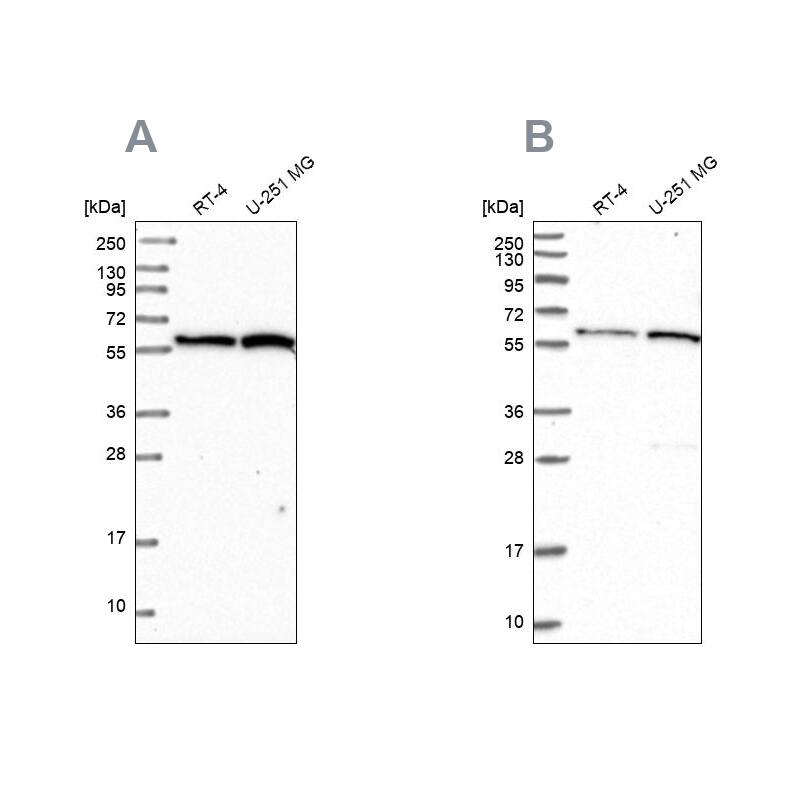 VWA9 Antibody - BSA Free Western Blot: VWA9 Antibody - BSA Free [NBP1-90524]
