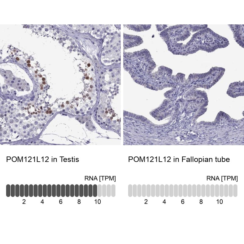 POM121L12 Antibody - BSA Free Immunohistochemistry: POM121L12 Antibody - BSA Free [NBP1-90526]
