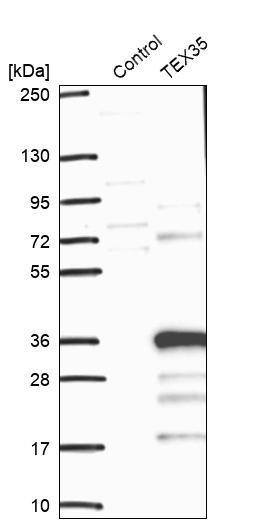 TEX35 Antibody - BSA Free Western Blot: TEX35 Antibody - BSA Free [NBP1-90530]