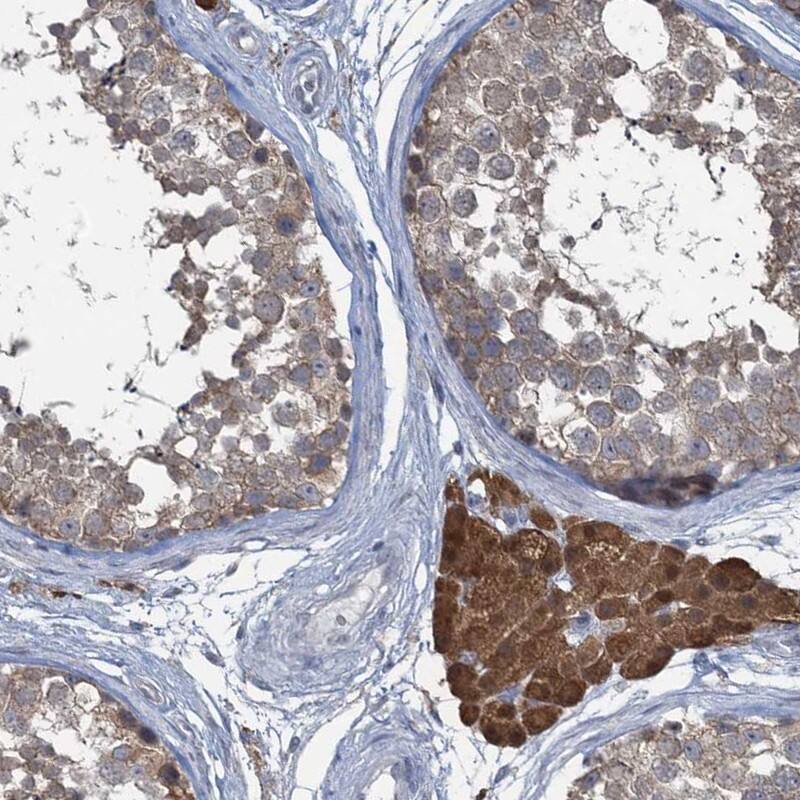 TEX35 Antibody - BSA Free Immunohistochemistry: TEX35 Antibody - BSA Free [NBP1-90530]